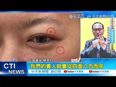 臉上長白毛拔掉|【臉上長白毛可以拔嗎】臉上驚現「白毛」！拔還是不拔？揭開吉。